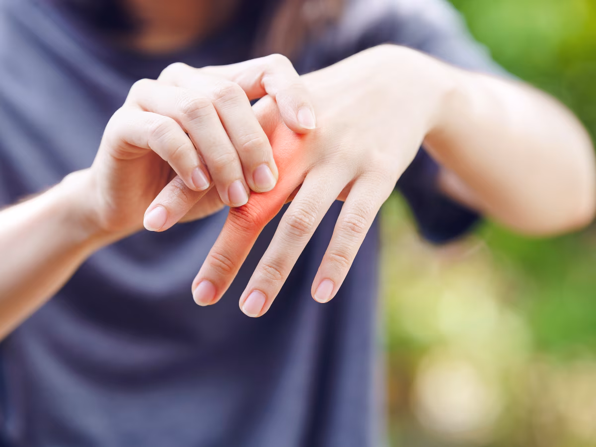 Arthritis Treatment and Care