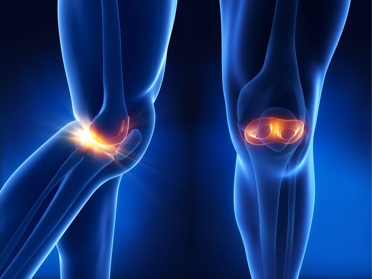 Joint Recovery