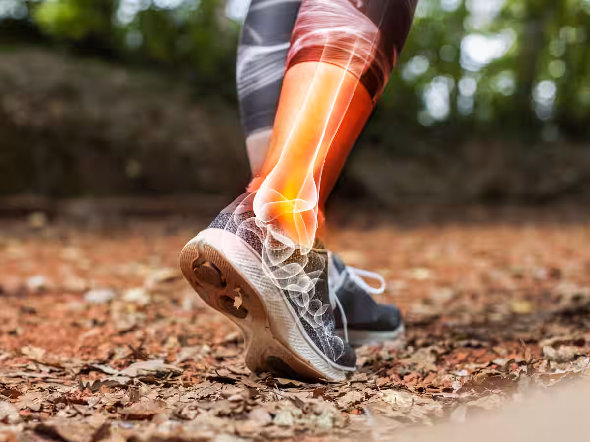 Common Sports Injuries